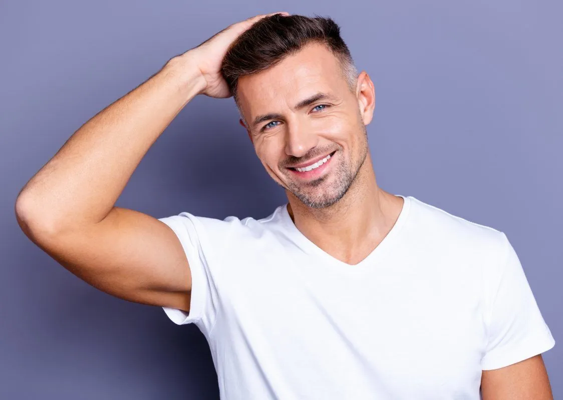 Haartransplantatie met de FUT-methode