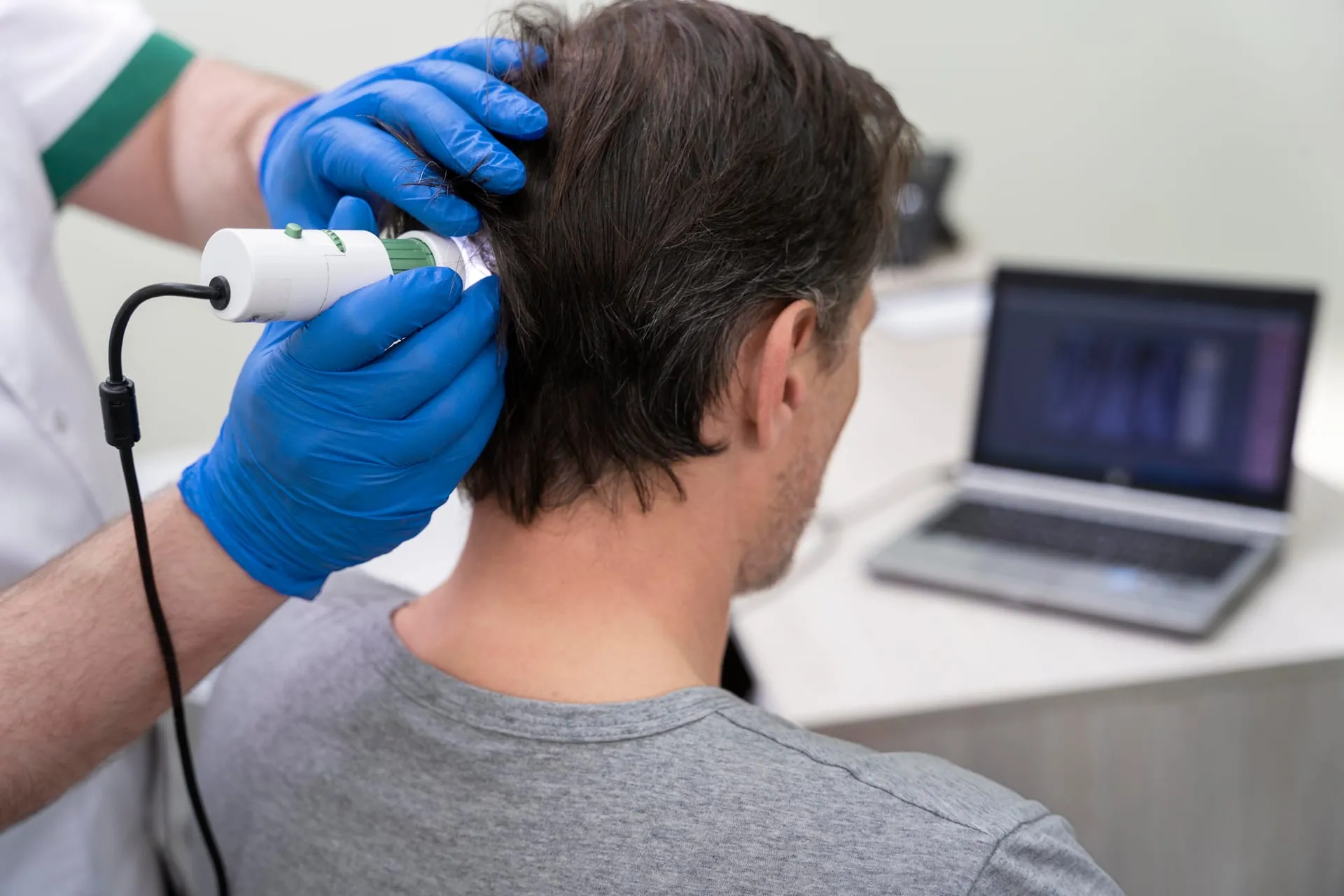 Onderzoek van de hoofdhuid met een dermatoscoop bij langer haar